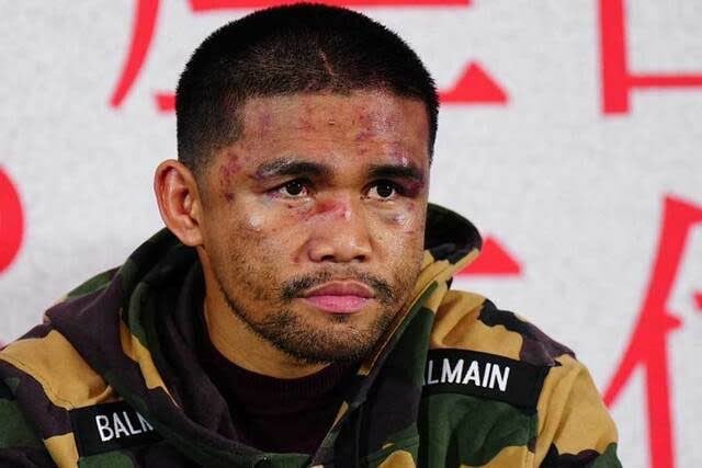 r/Boxing - Photos of Tapales and Inoue's Faces at the Post-Fight Presser