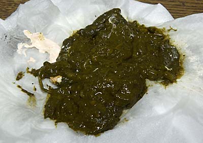 igu-v011227ay-01-diarrhea.jpg