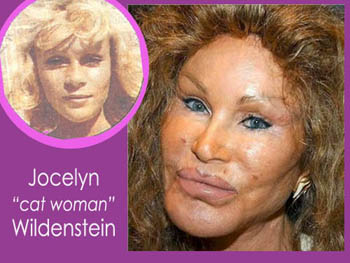 jocelyn-wildenstein-ba.jpg