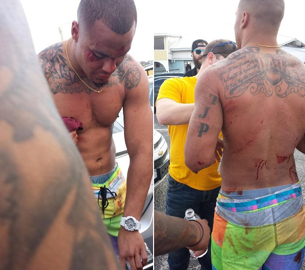 dak-prescott-bloodied.jpg