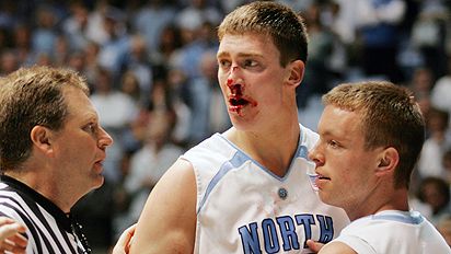 hansbrough_bloody.jpg