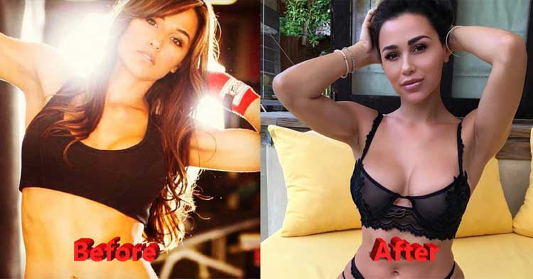 Ana-Cheri-before-plastic-surgery-1.jpg