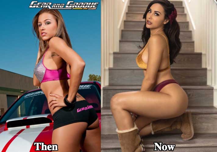 Ana-Cheri-before-plastic-surgery-4.jpg