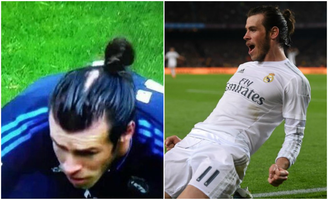 bale-2.jpg