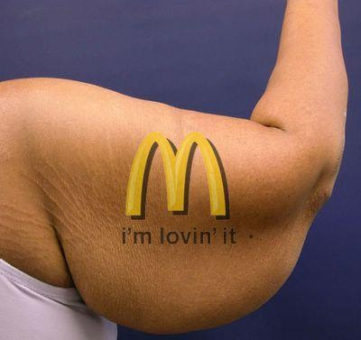 McFat-arm.jpg