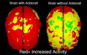 adderall-brain1.jpg