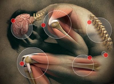 dolor-cronico%255B1%255D.jpg